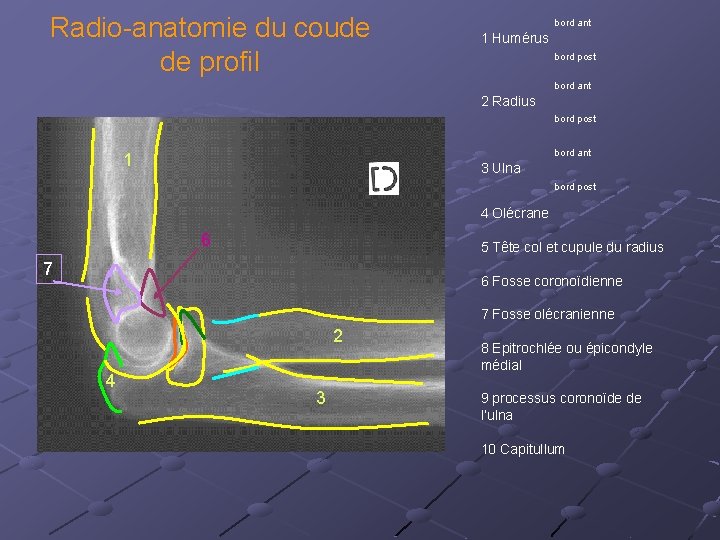 Radio-anatomie du coude de profil bord ant 1 Humérus bord post bord ant 2