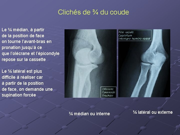 Clichés de ¾ du coude Le ¾ médian, à partir de la position de