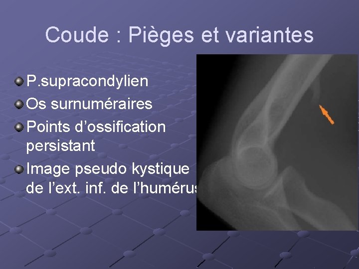 Coude : Pièges et variantes P. supracondylien Os surnuméraires Points d’ossification persistant Image pseudo