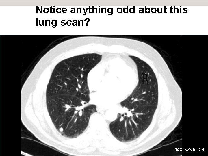 Notice anything odd about this lung scan? Photo: www. npr. org 