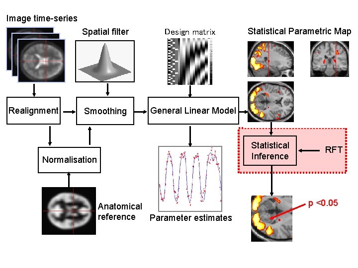 Image time-series Spatial filter Realignment Smoothing Design matrix Statistical Parametric Map General Linear Model