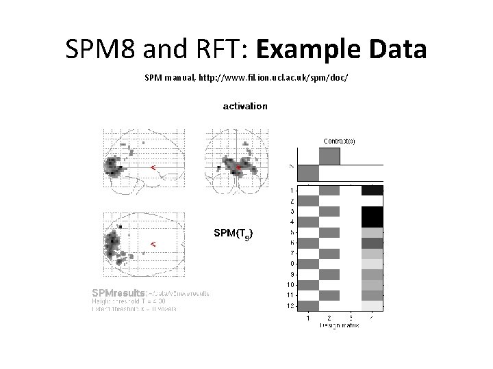 SPM 8 and RFT: Example Data SPM manual, http: //www. fil. ion. ucl. ac.