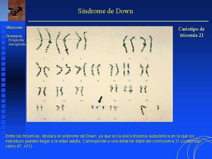 Síndrome de Down Mutaciones Genómicas Poliploidía Aneuploidía Cariotipo de trisomía 21 Entre las trisomías,