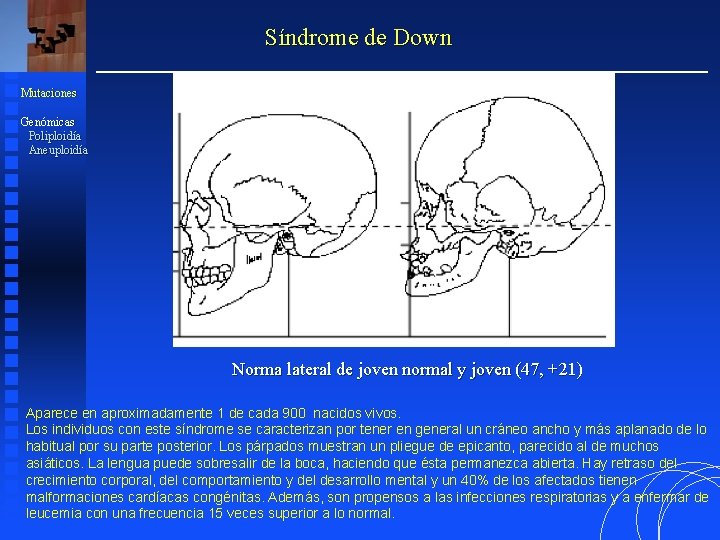 Síndrome de Down Mutaciones Genómicas Poliploidía Aneuploidía Norma lateral de joven normal y joven