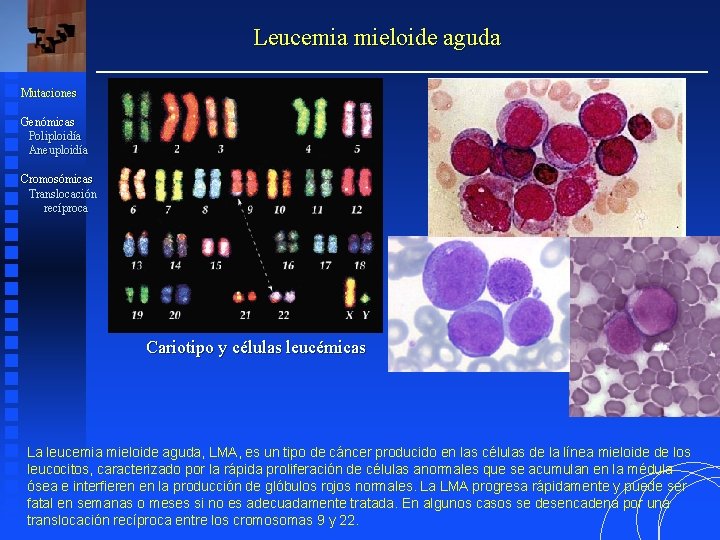 Leucemia mieloide aguda Mutaciones Genómicas Poliploidía Aneuploidía Cromosómicas Translocación recíproca Cariotipo y células leucémicas