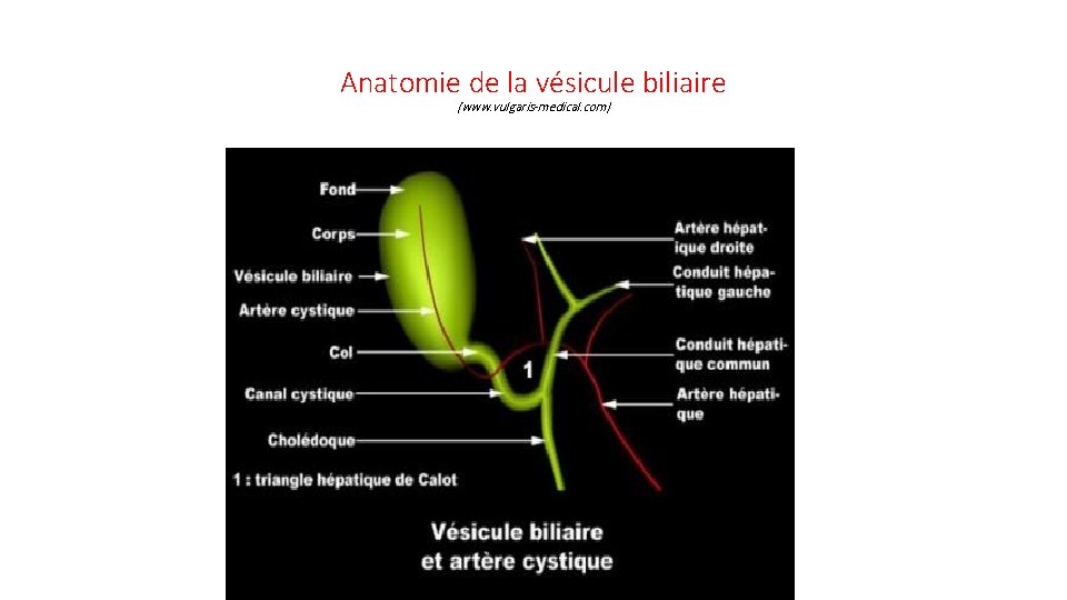 Anatomie de la vésicule biliaire (www. vulgaris-medical. com) 