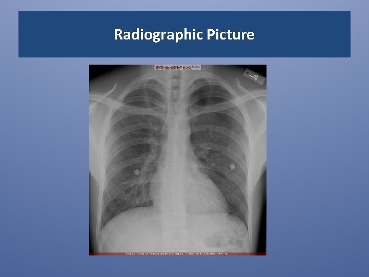 Radiographic Picture 