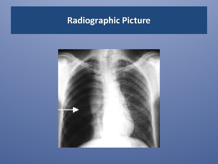 Radiographic Picture 