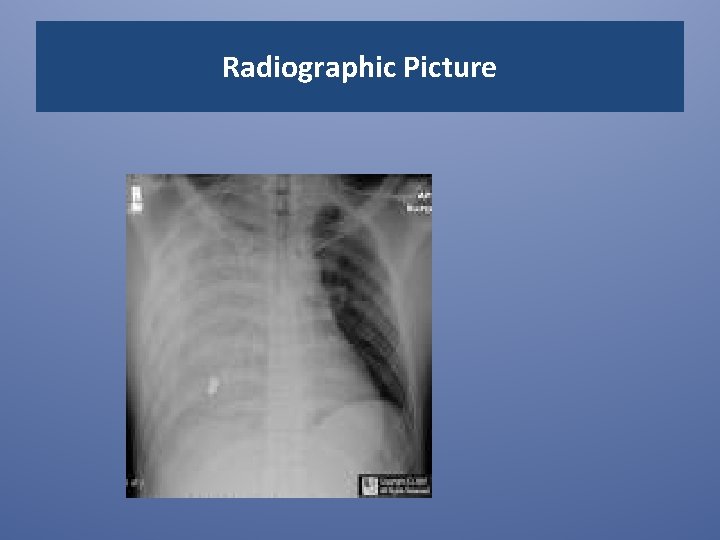 Radiographic Picture 