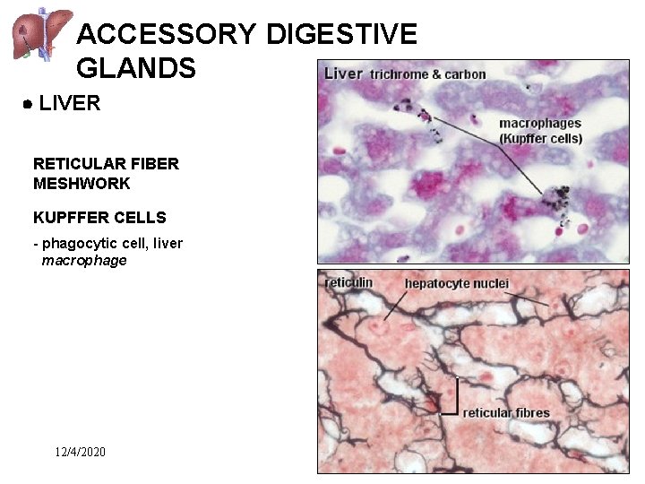ACCESSORY DIGESTIVE GLANDS LIVER RETICULAR FIBER MESHWORK KUPFFER CELLS - phagocytic cell, liver macrophage