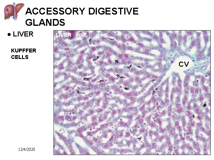 ACCESSORY DIGESTIVE GLANDS LIVER H&E KUPFFER CELLS CV 12/4/2020 