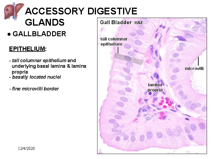 ACCESSORY DIGESTIVE GLANDS GALLBLADDER EPITHELIUM: - tall columnar epithelium and underlying basal lamina &