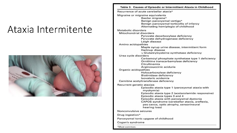 Ataxia Intermitente Ataxia Intermitente