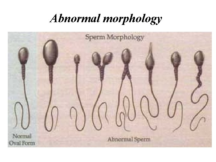 Abnormal morphology 