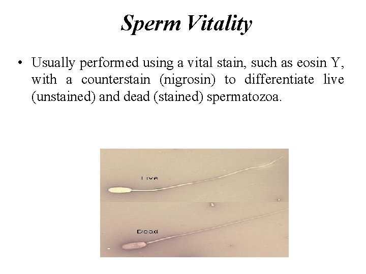 Sperm Vitality • Usually performed using a vital stain, such as eosin Y, with