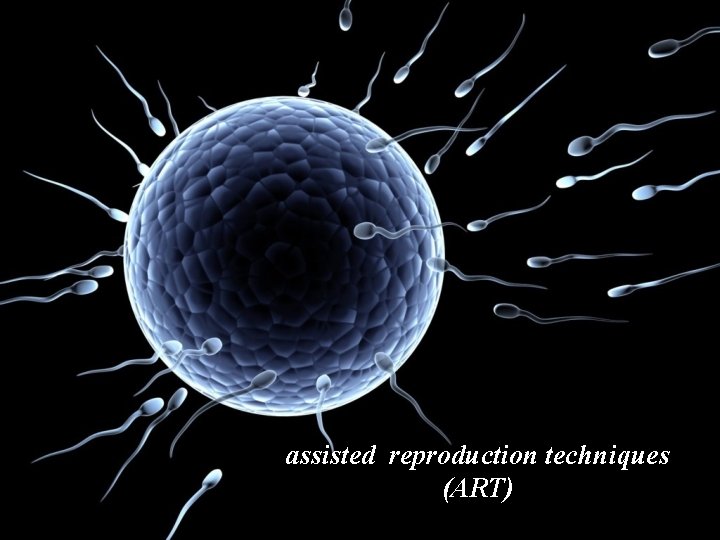 assisted reproduction techniques (ART) 