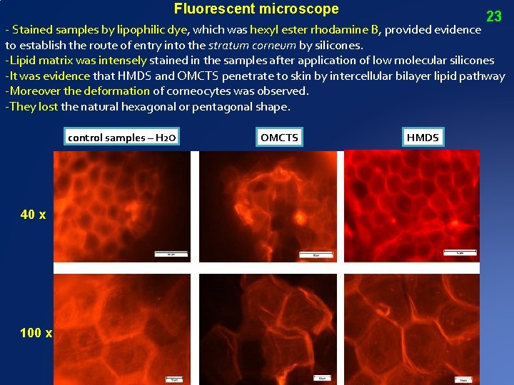 Fluorescent microscope 23 - Stained samples by lipophilic dye, which was hexyl ester rhodamine