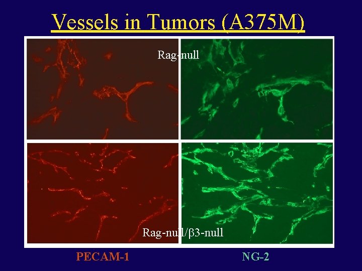 Vessels in Tumors (A 375 M) Rag-null/ 3 -null PECAM-1 NG-2 