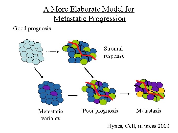 A More Elaborate Model for Metastatic Progression Good prognosis Stromal response Metastatic variants Poor A More Elaborate Model for Metastatic Progression Good prognosis Stromal response Metastatic variants Poor