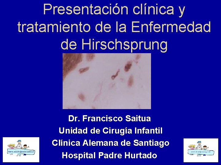 Presentación clínica y tratamiento de la Enfermedad de Hirschsprung Dr. Francisco Saitua Unidad de
