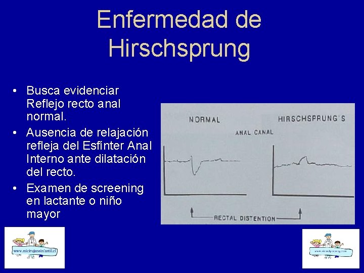 Enfermedad de Hirschsprung • Busca evidenciar Reflejo recto anal normal. • Ausencia de relajación