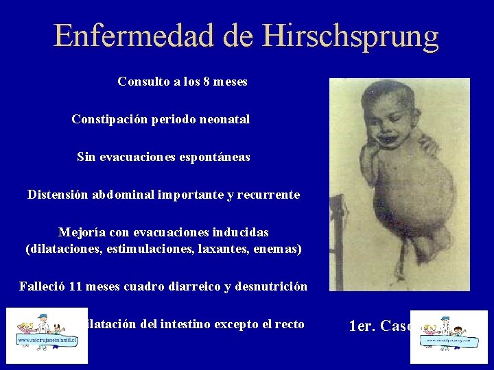 Enfermedad de Hirschsprung Consulto a los 8 meses Constipación periodo neonatal Sin evacuaciones espontáneas