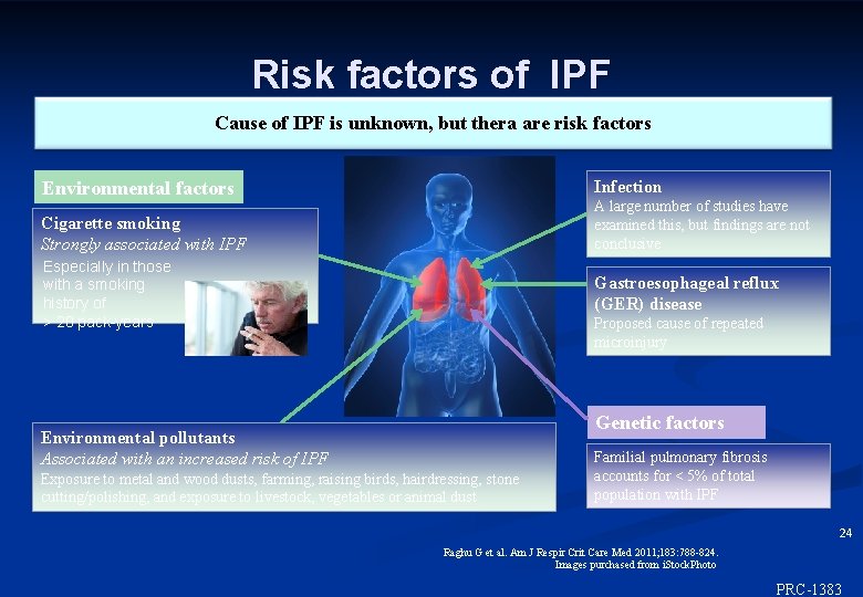 Risk factors of IPF Cause of IPF is unknown, but thera are risk factors