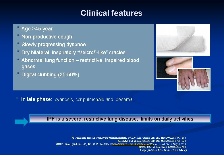 Clinical features } } } Age >45 year Non-productive cough Slowly progressing dyspnoe Dry