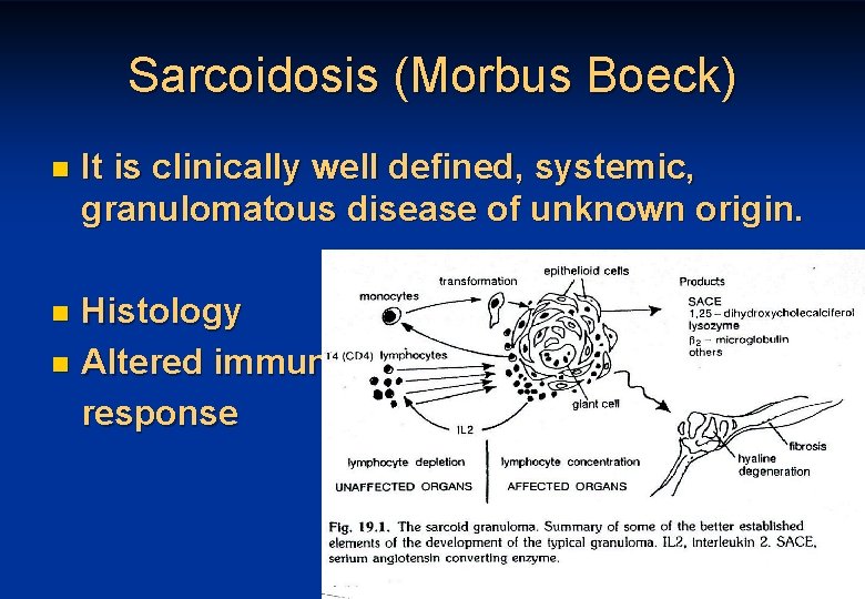 Sarcoidosis (Morbus Boeck) n It is clinically well defined, systemic, granulomatous disease of unknown