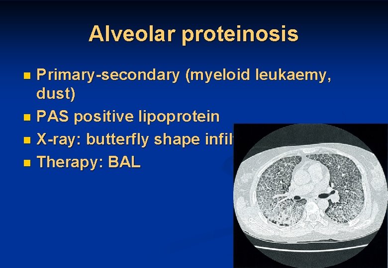 Alveolar proteinosis Primary-secondary (myeloid leukaemy, dust) n PAS positive lipoprotein n X-ray: butterfly shape