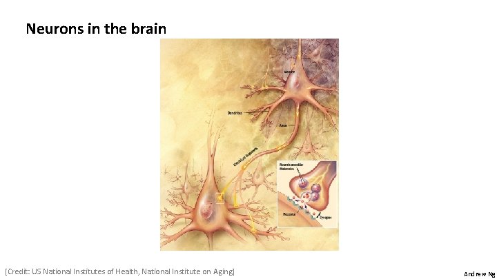 Neurons in the brain [Credit: US National Institutes of Health, National Institute on Aging]