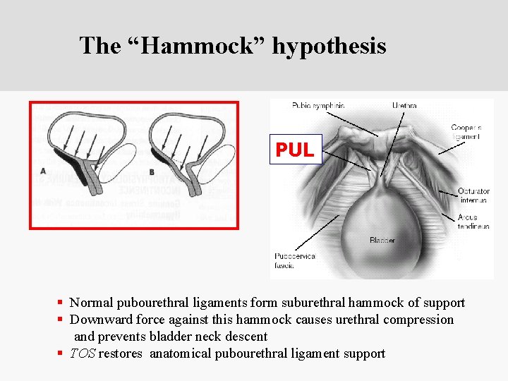 hammock hypothesis