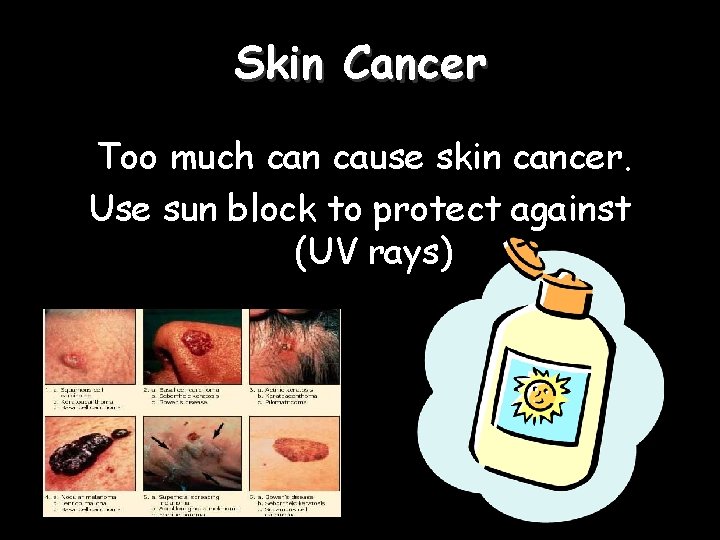 Skin Cancer Too much can cause skin cancer. Use sun block to protect against