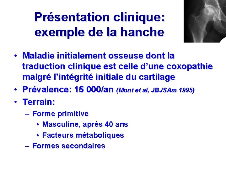 Présentation clinique: exemple de la hanche • Maladie initialement osseuse dont la traduction clinique