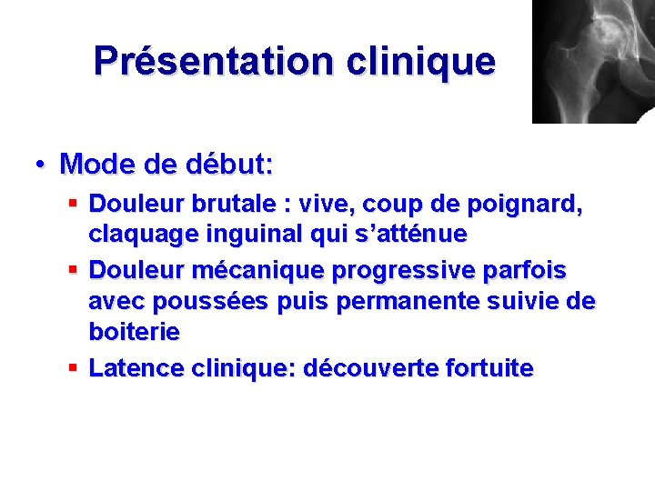 Présentation clinique • Mode de début: § Douleur brutale : vive, coup de poignard,