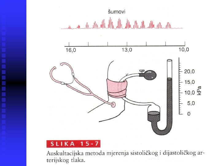 arterijsko mjerenje tlaka