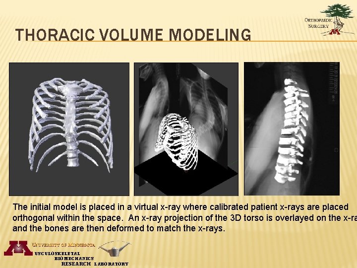 THORACIC VOLUME MODELING The initial model is placed in a virtual x-ray where calibrated