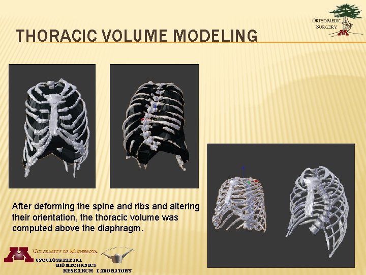 THORACIC VOLUME MODELING After deforming the spine and ribs and altering their orientation, the
