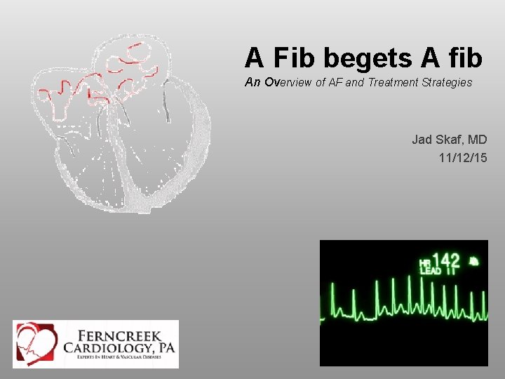 A Fib begets A fib An Overview of AF and Treatment Strategies Jad Skaf,