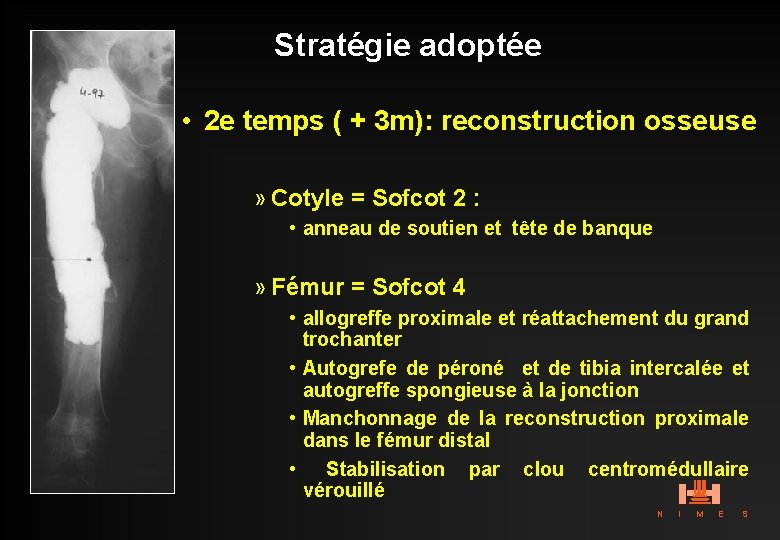 Stratégie adoptée • 2 e temps ( + 3 m): reconstruction osseuse » Cotyle