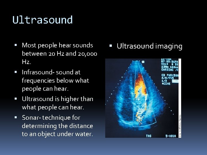 Ultrasound Most people hear sounds between 20 Hz and 20, 000 Hz. Infrasound- sound