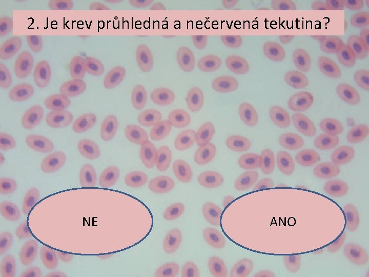 2. Je krev průhledná a nečervená tekutina? NE ANO 