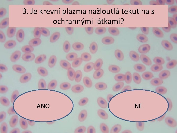 3. Je krevní plazma nažloutlá tekutina s ochrannými látkami? ANO NE 