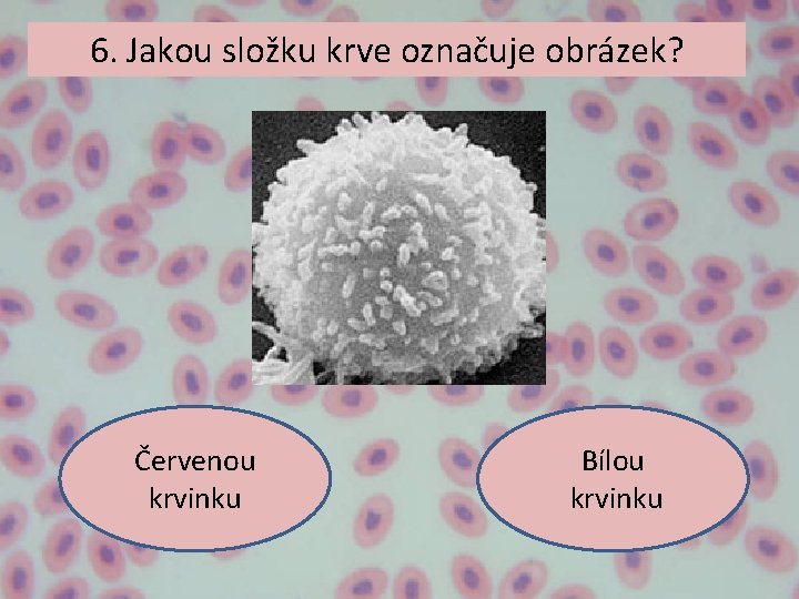 6. Jakou složku krve označuje obrázek? Červenou krvinku Bílou krvinku 6. Jakou složku krve označuje obrázek? Červenou krvinku Bílou krvinku