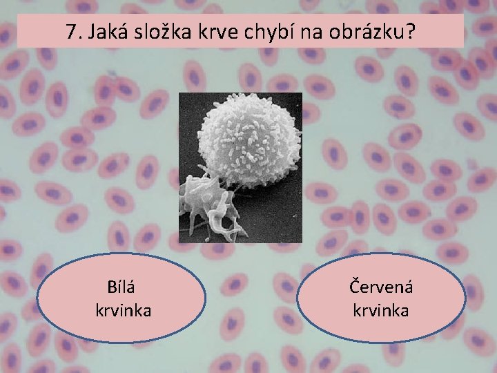 7. Jaká složka krve chybí na obrázku? Bílá krvinka Červená krvinka 