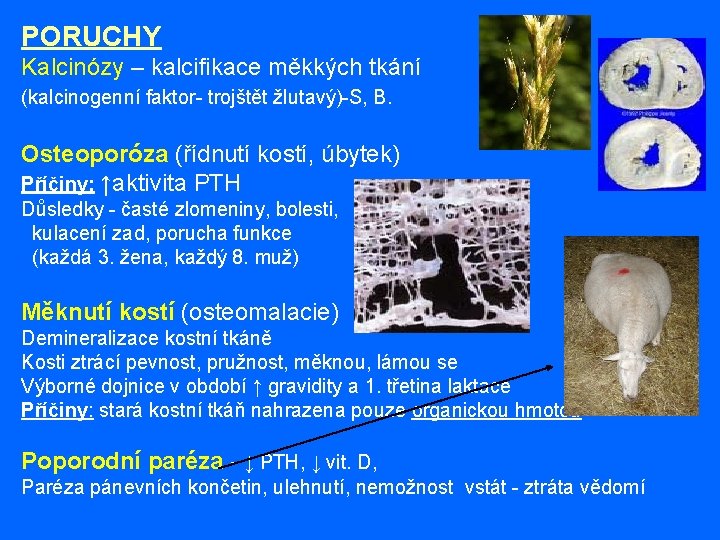 PORUCHY Kalcinózy – kalcifikace měkkých tkání (kalcinogenní faktor- trojštět žlutavý)-S, B. Osteoporóza (řídnutí kostí,
