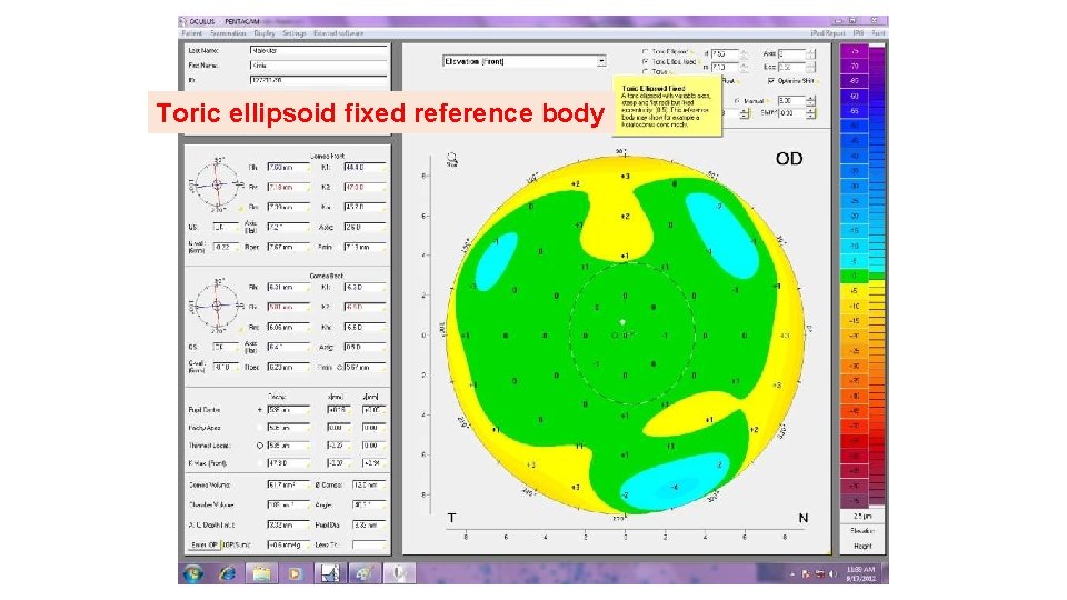 Toric ellipsoid fixed reference body 