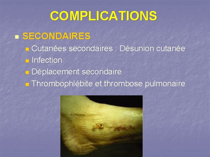 COMPLICATIONS n SECONDAIRES Cutanées secondaires : Désunion cutanée n Infection n Déplacement secondaire n