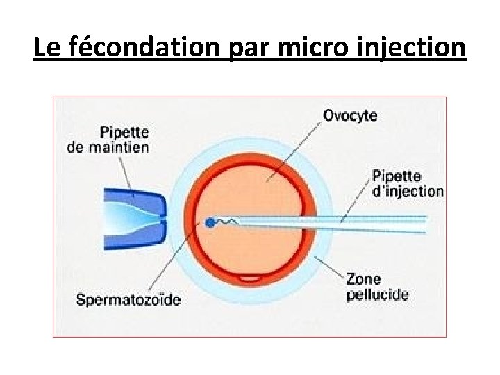 Le fécondation par micro injection 