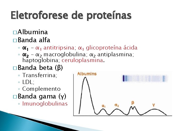 Eletroforese de proteínas � Albumina � Banda alfa � Banda beta (β) � Banda